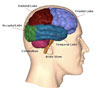 March is Brain Injury Awareness Month